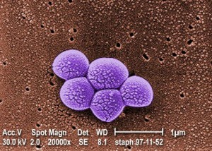 MRSA Bacteria Magnified 20,000X