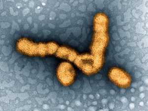 Influenza Virus Testing
