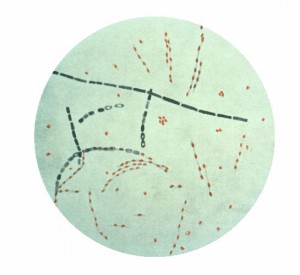 Bacillus anthracis from agar culture. Photomicrograph of Bacillus anthracis from an agar culture demonstrating spores; Fuchsin-methylene blue spore stain. Anthrax