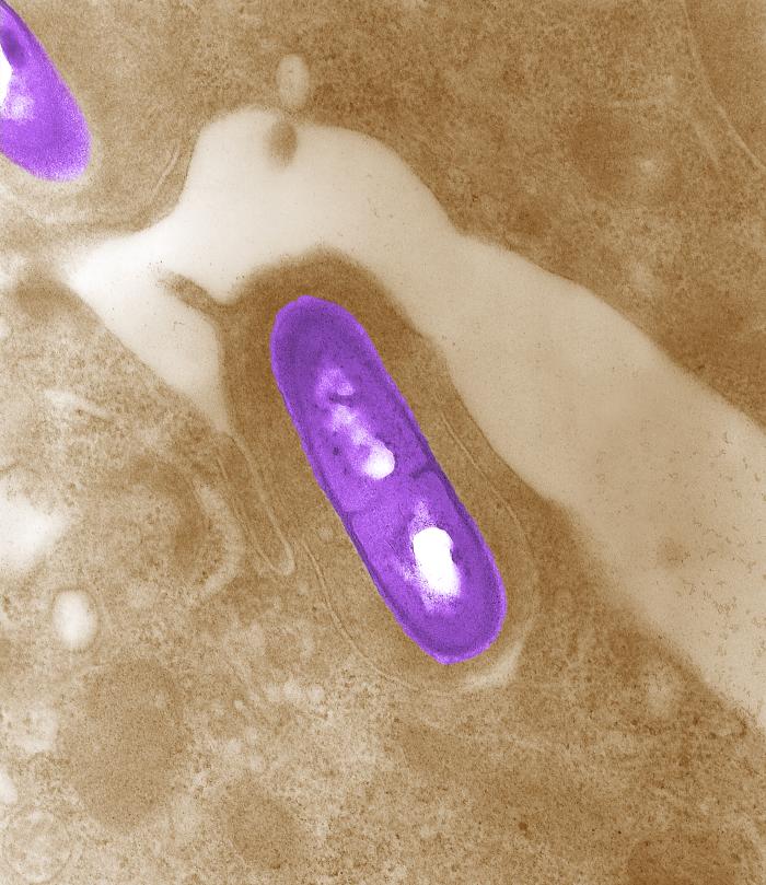 Food Recalls for the Bacteria Listeria | Food Safety Microbiology