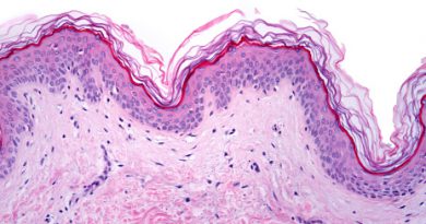 Different Histology Stains and Tools used in Histology Staining